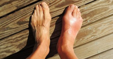 foot pain relief cream-foot pain relief-foot pain cream-foot pain